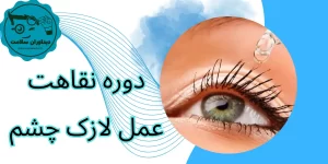 دوره نقاهت عمل لازک چشم