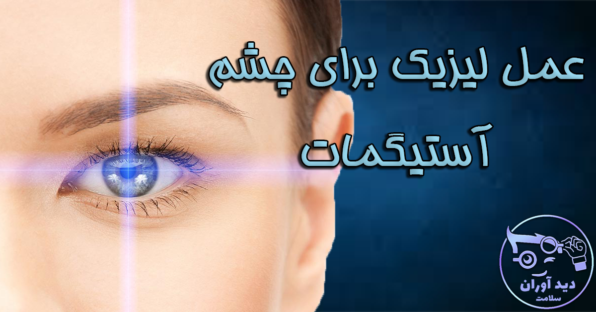 عمل لیزیک برای چشم آستیگمات